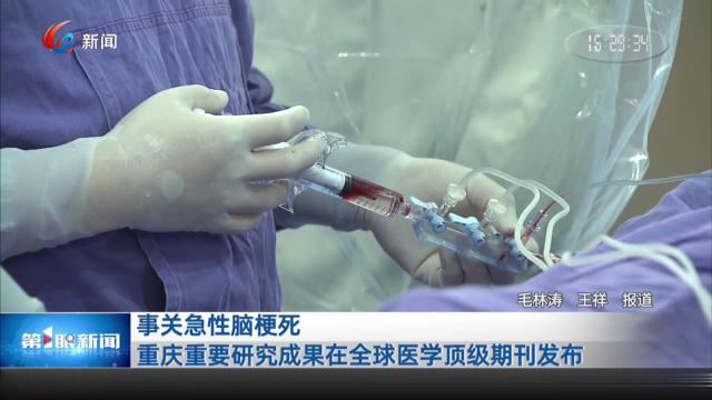 事关急性脑梗死 重庆重要研究成果在全球医学顶级期刊发布