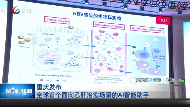 重庆发布全球首个面向乙肝治愈场景的AI智能助手