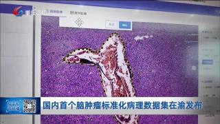 国内首个脑肿瘤标准化病理数据集在渝发布